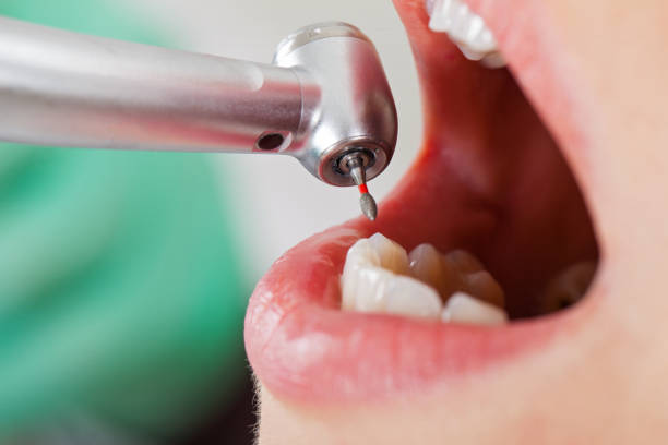 Best Emergency Tooth Extraction  in Pelham, GA